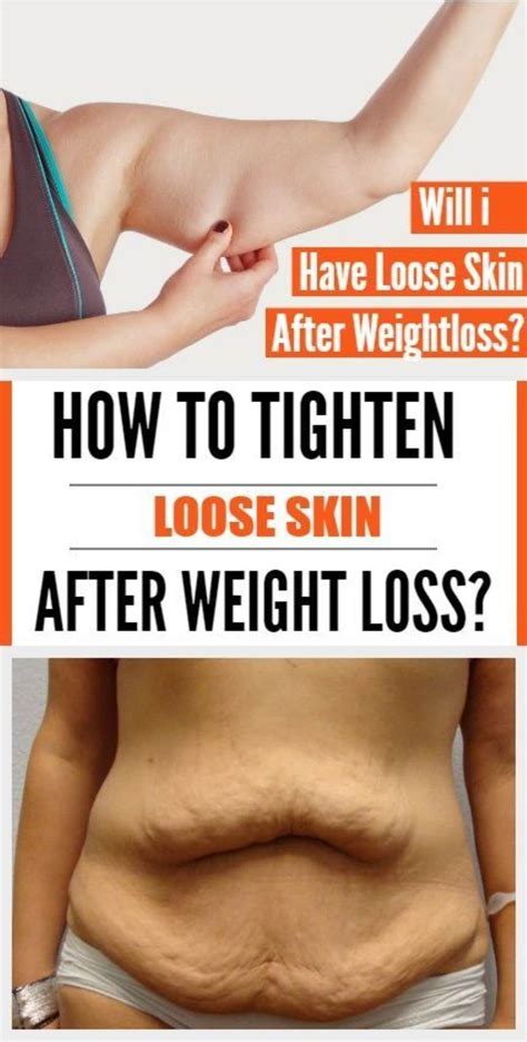 How to Tighten Loose Skin and Sagging Skin | Tighten loose skin, Loose skin, Skin tightening stomach
