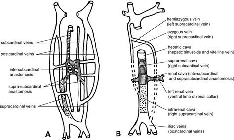 Agenesis Of The Inferior Vena Cava Associated With Lower Extremities