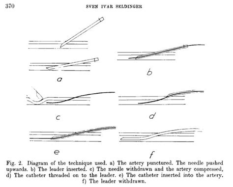 Central Venous Access Device Insertion Deranged Physiology