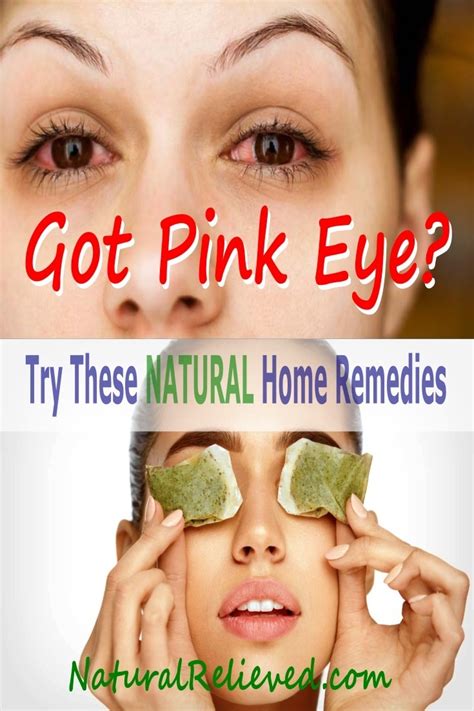 Natural Pink Eye Remedy To Keep It From Spreading Naturalrelieved