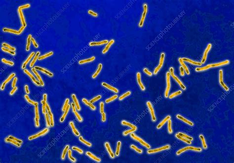 Diphtheria Bacilli Stock Image C0282270 Science Photo Library
