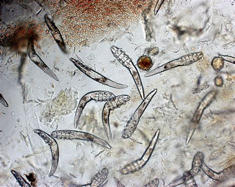 25 Unique Is Demodex Zoonotic Demodectic Mange