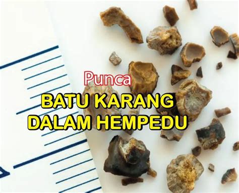 Ketahui lebih lanjut berkenaan isu ini dalam penulisan artikel di bawah. Cara Atasi Masalah Batu Karang Hempedu Ketika Mengandung