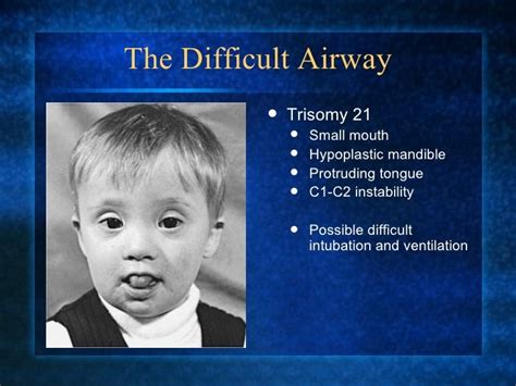 Cr Pediatrics Residents Airway Management Part 2