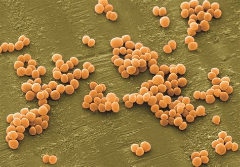 Staphylococcus Aureus Să Crești Mare Odoraș