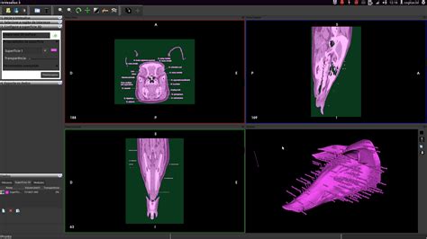 ator converting a video of computed tomography into a 3d mesh