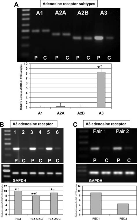 Semiquantitative Rt Pcr Analysis Of Adenosine Receptor Mrnas Expressed Download Scientific