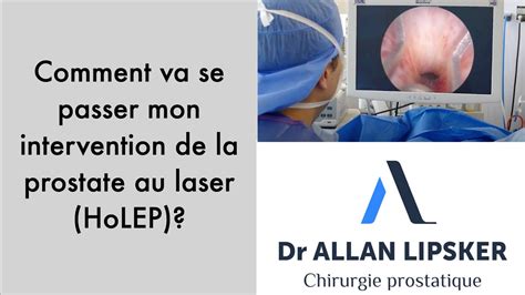 Lholep Ou Chirurgie De La Prostate Au Laser Expliquée Aux Patients