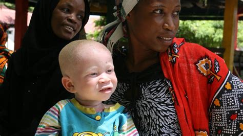 Tanzanian Police Arrested 200 Witchdoctors Linked To Albino Murders And