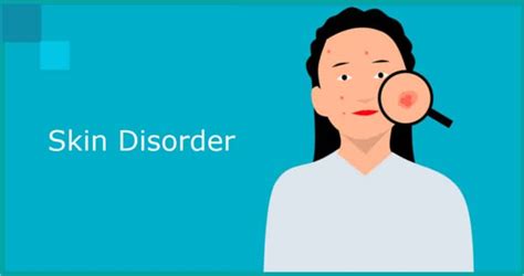 Blue Skin Disorder Symptoms Causes Treatment