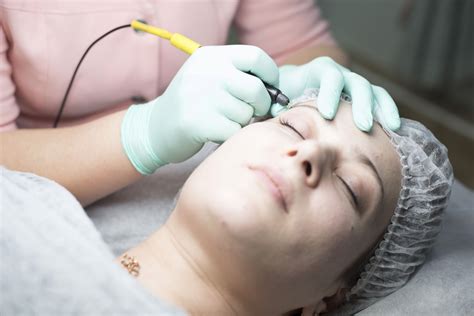 Electrolysis Vs Laser Hair Removal Vargas Face And Skin Center
