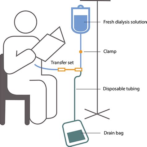 Peritoneal Dialysis Niddk