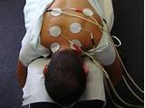 Photos of Electrical Stimulation Physical Therapy Machines