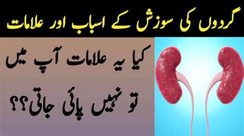 Blood in your diarrhea or black, tarry stools. Kidney problem in urdu hindi - YouTube