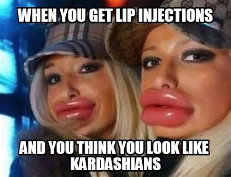 Powtoday On Twitter Lip Injections Gone Wrong😂😂 Lip Lipinjections