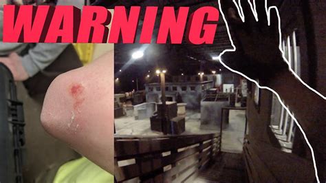 My Worst Airsoft Injury Bleeding Youtube