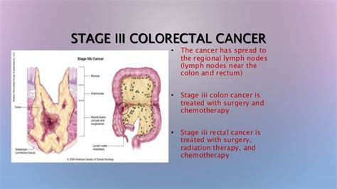Colerectal Cancer Causes Symptoms And Treatments Global Treatment