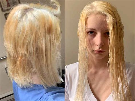 You can also buy kits for bleaching the hair you will need to bleach your hair only if you are planning to go lighter than your natural or already dyed hair color. Can I Lighten My Hair With 20 Volume Developer - The Best ...