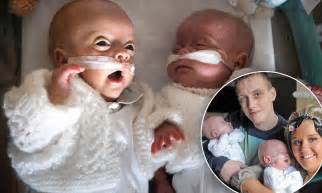 Twins Born Weeks Prematurely Spend Almost Six Months In Hospital