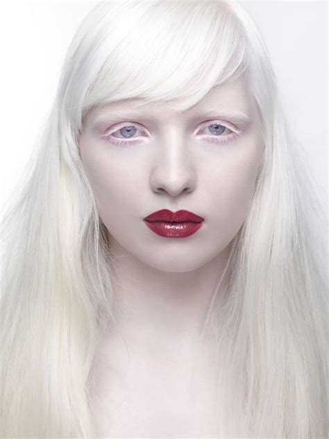 Альбинос белые волосы, белые ресницы. Pin em Nastya Zhidkova Albino Model