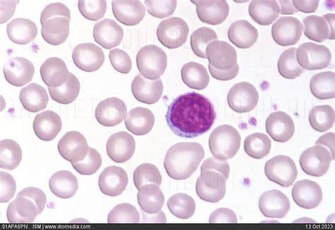 Stock Image Photomicrograph Of A Normal Human Blood Smear Showing One