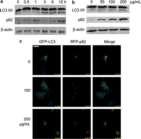 Hamlet Induced Autophagic Response In Lc3 Protein Levels And