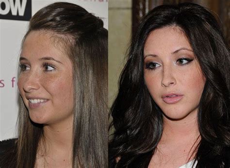 Yes, bristol palin is sarah's daughter. Bristol Palin Corrective Jaw Surgery 'New Look'New Celebrity