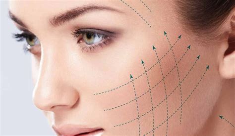 Non Surgical Facelifts And Skin Tightening Define London