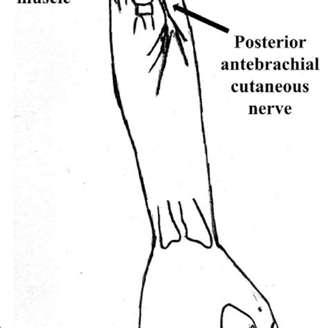 Anatomy Of The Posterior Antebrachial Cutaneous Nerve Revisited My