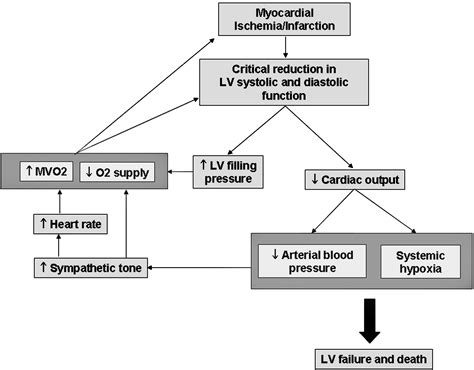 Pathophysiology Of Cardiogenic Shock Complicating Acute Myocardial