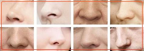 Nose Shapes Their Significance Types And What They Mean