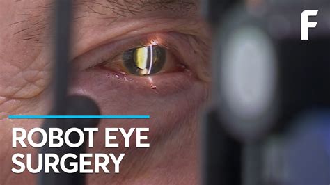 A Robot Just Performed The First Ever Surgery Inside The Human Eye