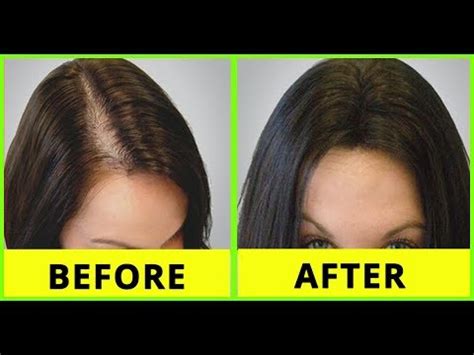 Home beauty tips beauty hacks beauty ideas hair growth tips in tamil onion juice for hair fast hairstyles natural health tips good life quotes skin care tips. Tamil Beauty Tips | How to grow hair on forehead - hair ...