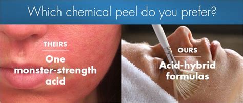 Pin On Chemical Peels