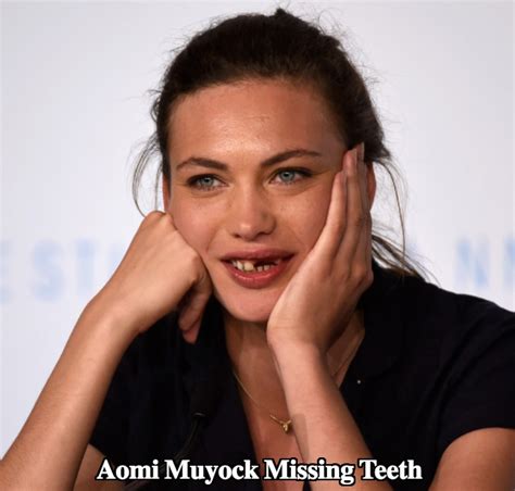 Aomi Muyock Teeth Her Missing Teeth Gap
