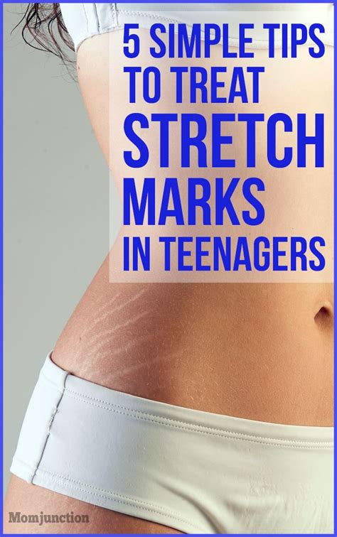stretch marks on back of teenager pictures pic side