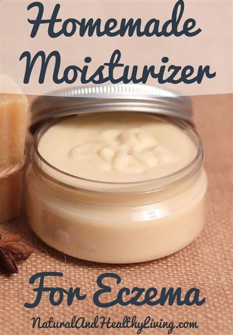 Psoriasis Diet This Is A Homemade Eczema Cream Recipe Its All
