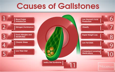 Gallbladder Stone Symptoms Symptoms Of Disease