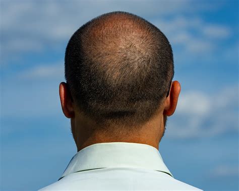 Best Haircuts For Balding Crown