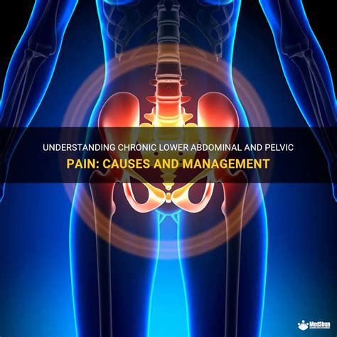 Understanding Chronic Lower Abdominal And Pelvic Pain Causes And Management Medshun