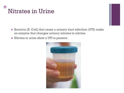 Nitrites In Urine Urine Routine And Microscopic Rapid Strip Test Viral Fr