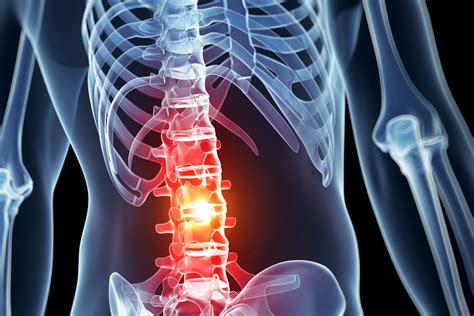 ¿cómo Afectan Las Lesiones De La Médula Espinal Al Cuerpo Película