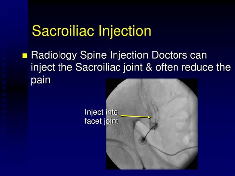Ppt Sacroiliac Joint Injection Powerpoint Presentation Free Download