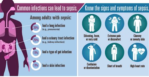 Sepsis Symptoms Top 7 Signs Of Sepsis And Stages Of T