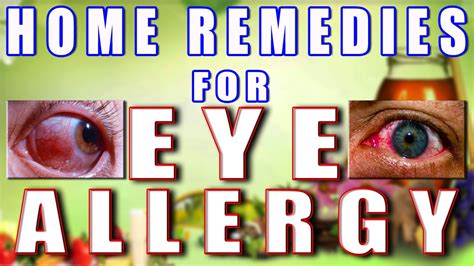 Home Remedies For Eye Allergy Youtube