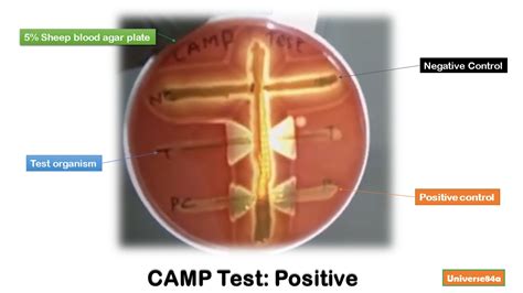 Camp Test Introduction Principle Test Requirements Test Procedure R