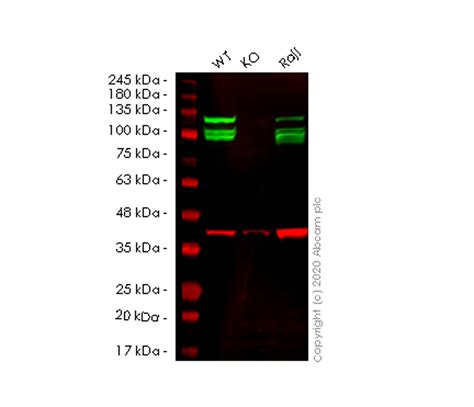 Results For Ap5 Abcam Antibodies Proteins Kits