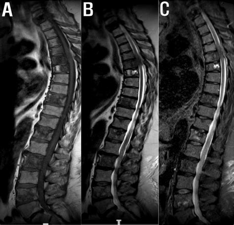 Full Length Spine Ct And Mri In Daily Practice Radiology Key
