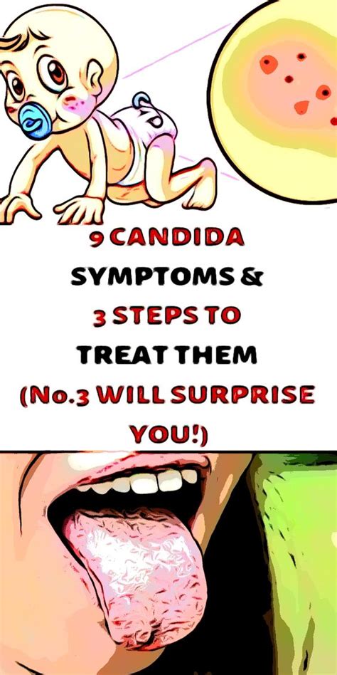 9 Candida Symptoms And 3 Steps To Treat Them Healthy Lifestyle