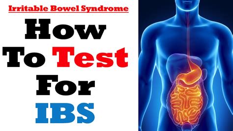 Tests And Diagnosis For Irritable Bowel Syndrome Ask Eric Bakker Youtube